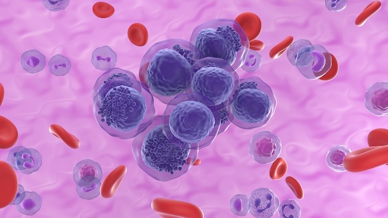 EHA