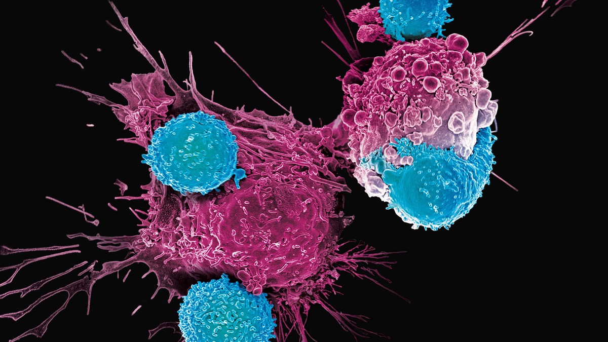 CAR T cells