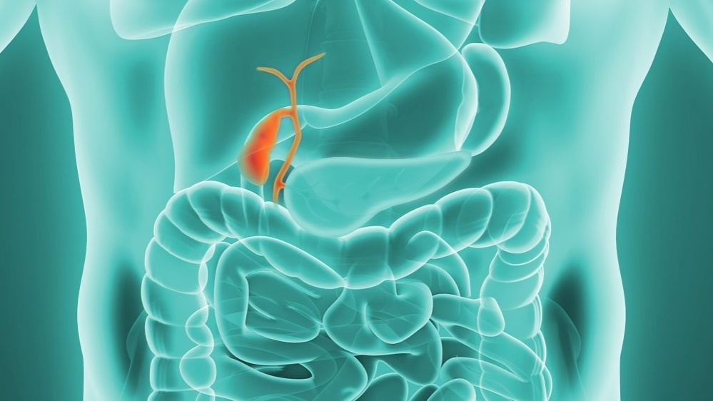 Senthil kumar Bladder Cancer