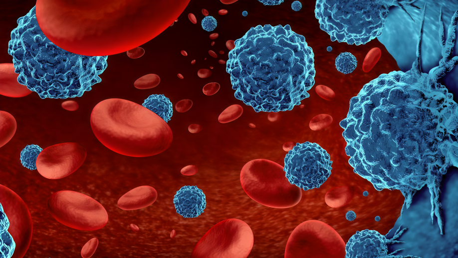 Hematologic Malignancies