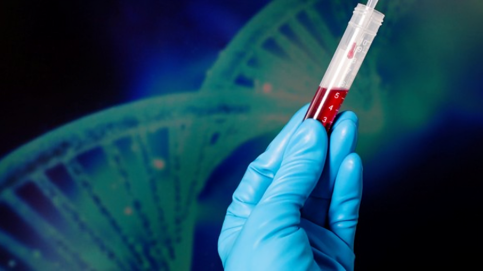 International Society of Liquid Biopsy