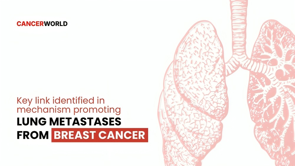 Lung Metastases