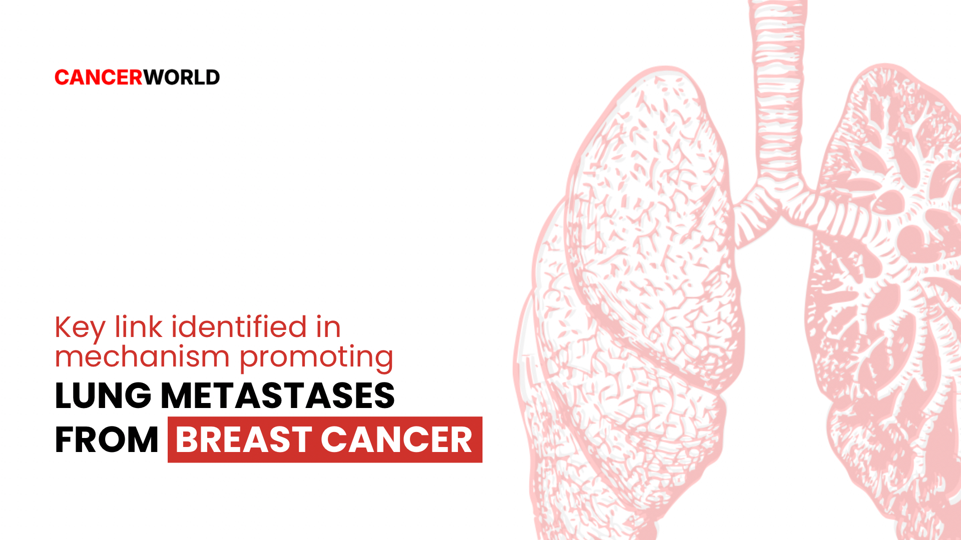 lung metastases