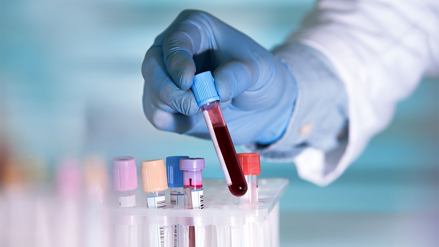 Liquid Biopsy in Clinical Practice: Past, Present and Future - ISLB