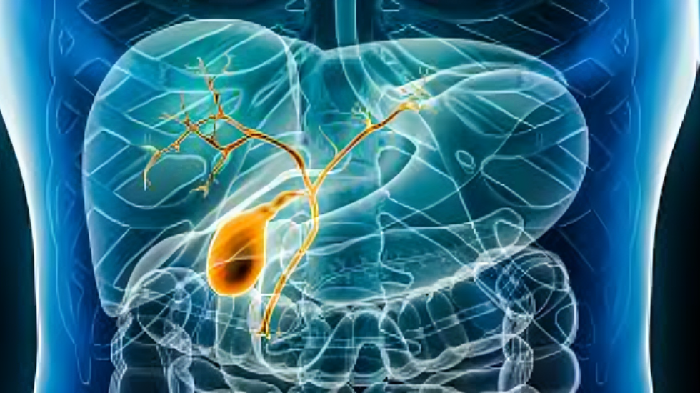 Biliary Tract Cancer
