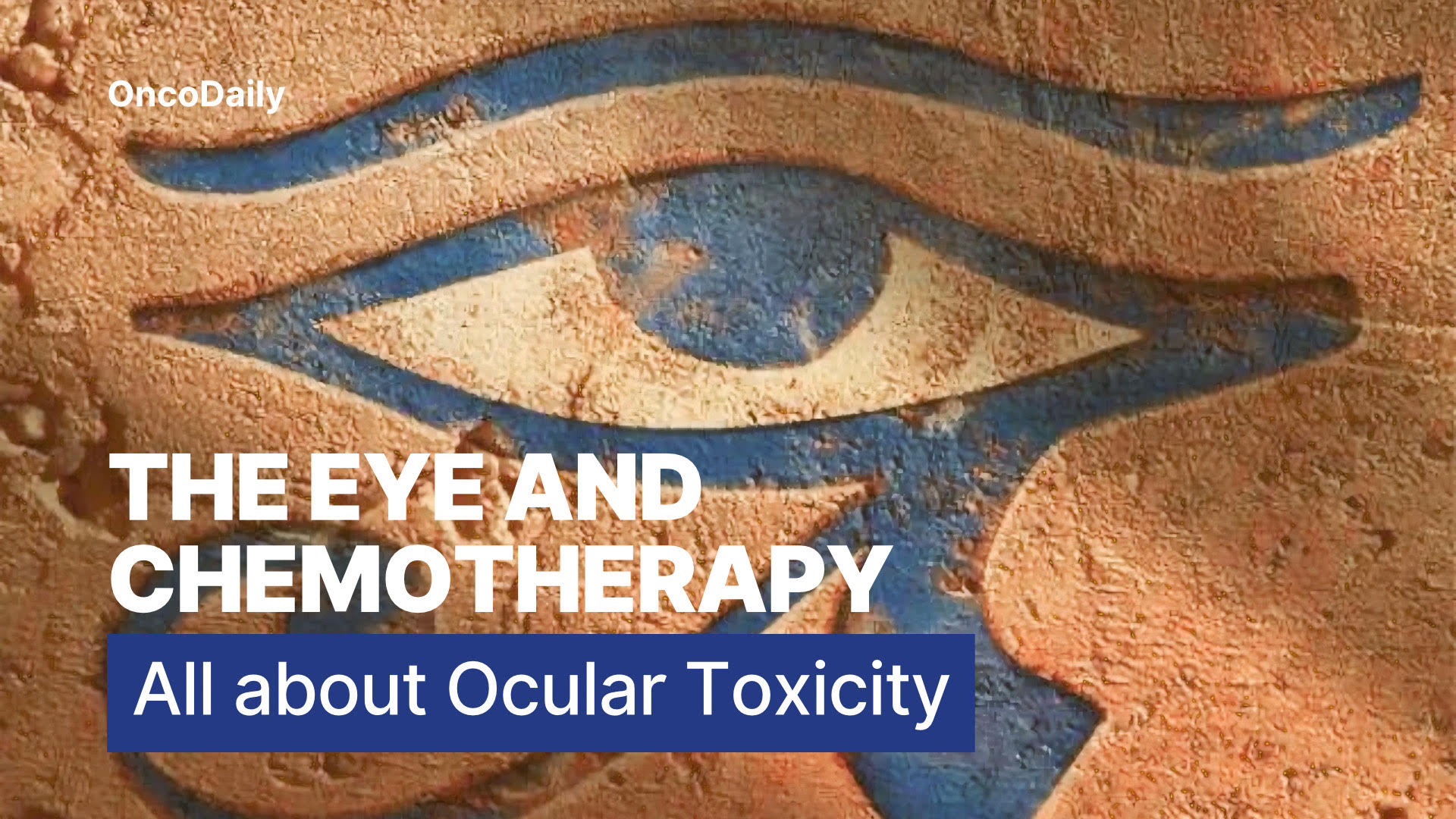 Ocular side effects of chemotherapy poster