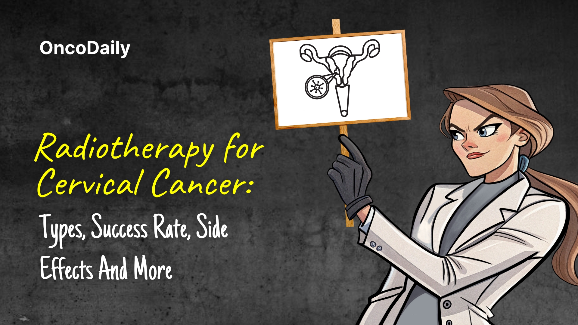 Radiotherapy for Cervical Cancer