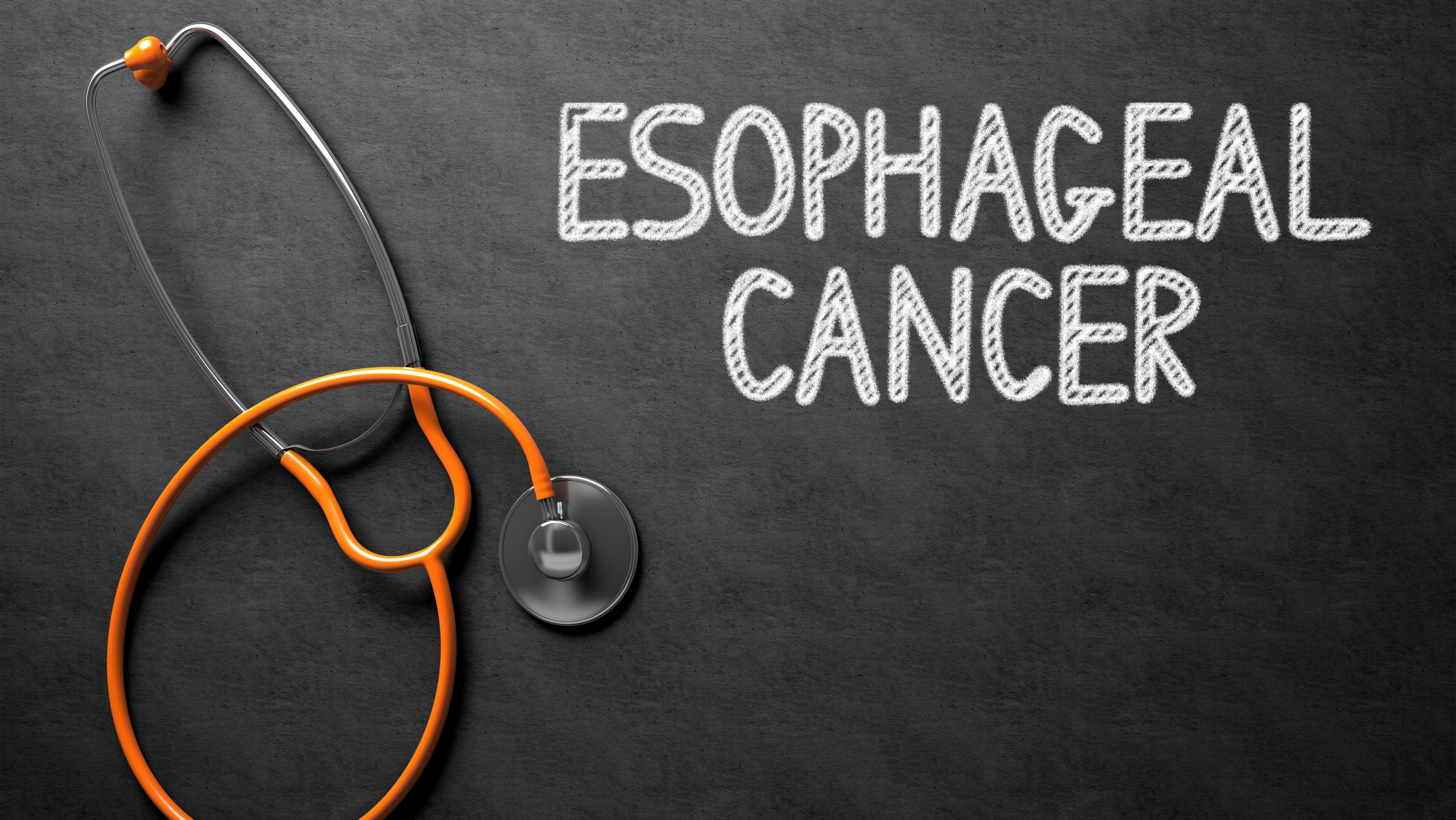 esophageal carcinogenesis