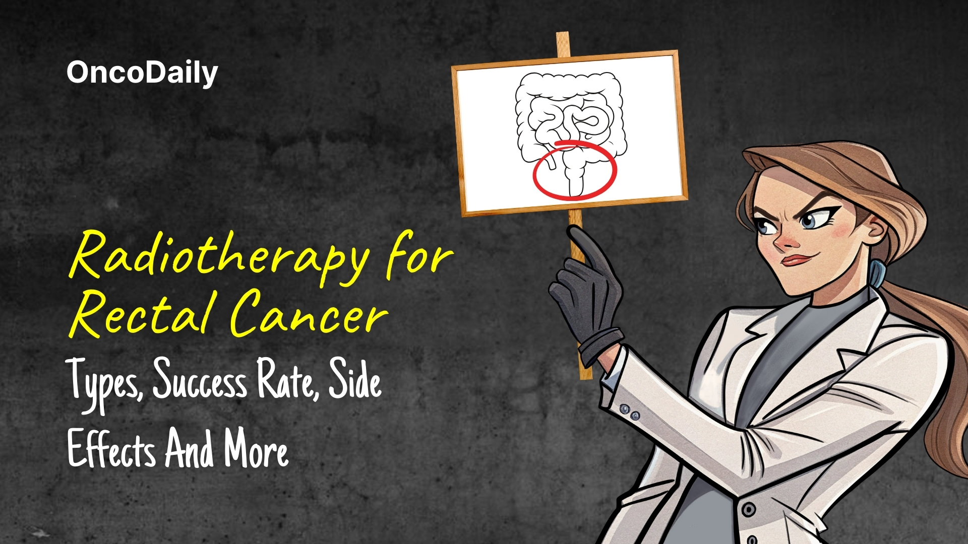 radiotherapy for rectal cancer