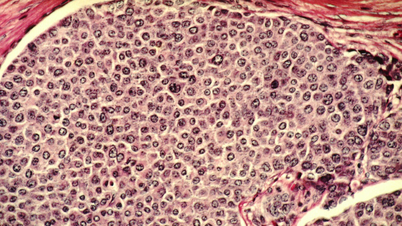 prolactin