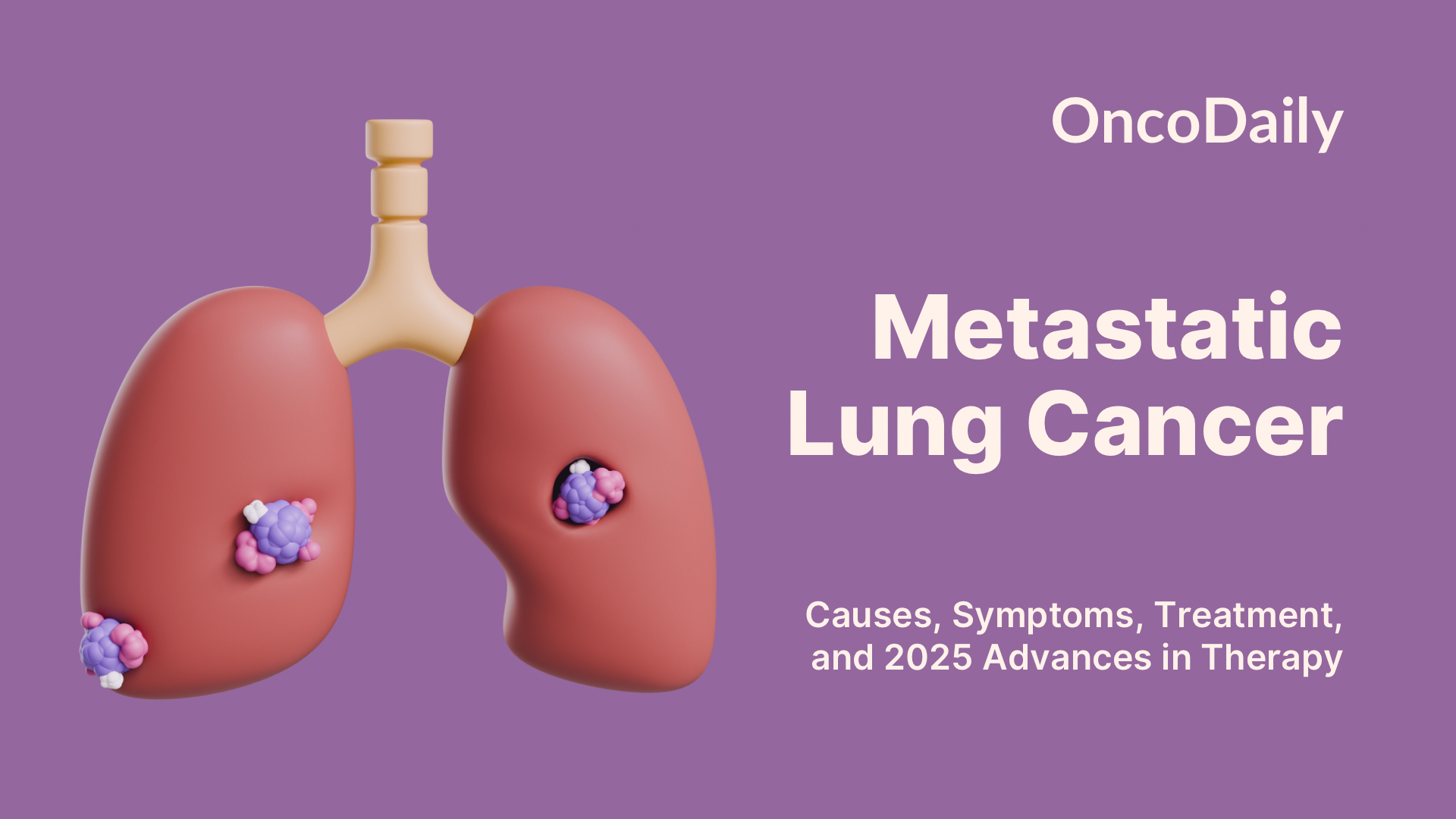 Metastatic Lung Cancer: Causes, Symptoms, Treatment, and 2025 Advances in Therapy