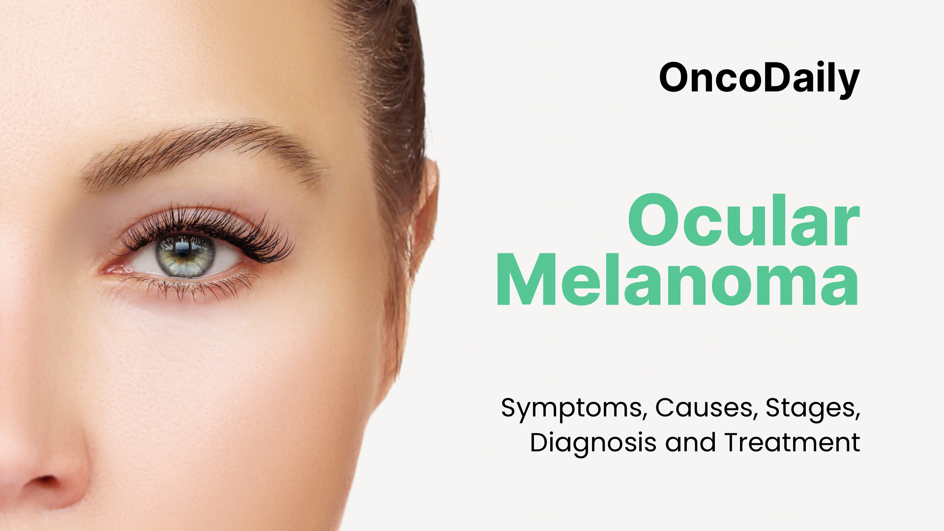 Ocular Melanoma Oncodaily