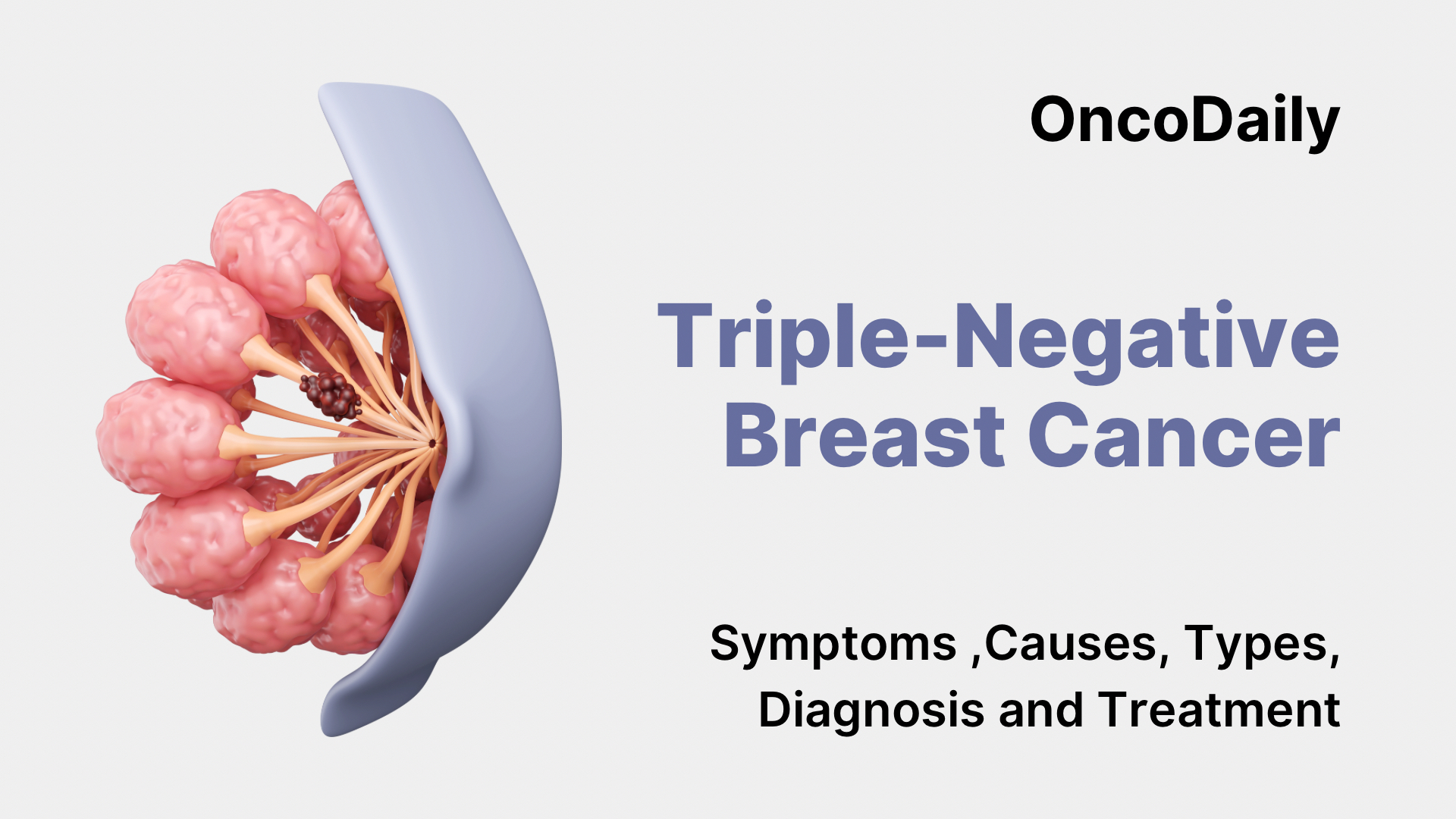 Triple-Negative Breast Cancer: Symptoms ,Causes, Types, Diagnosis and​ Treatment