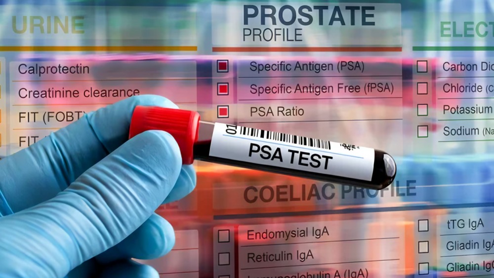 50 % of men will have a rising PSA after prostatectomy for Prostate Cancer - ASCO
