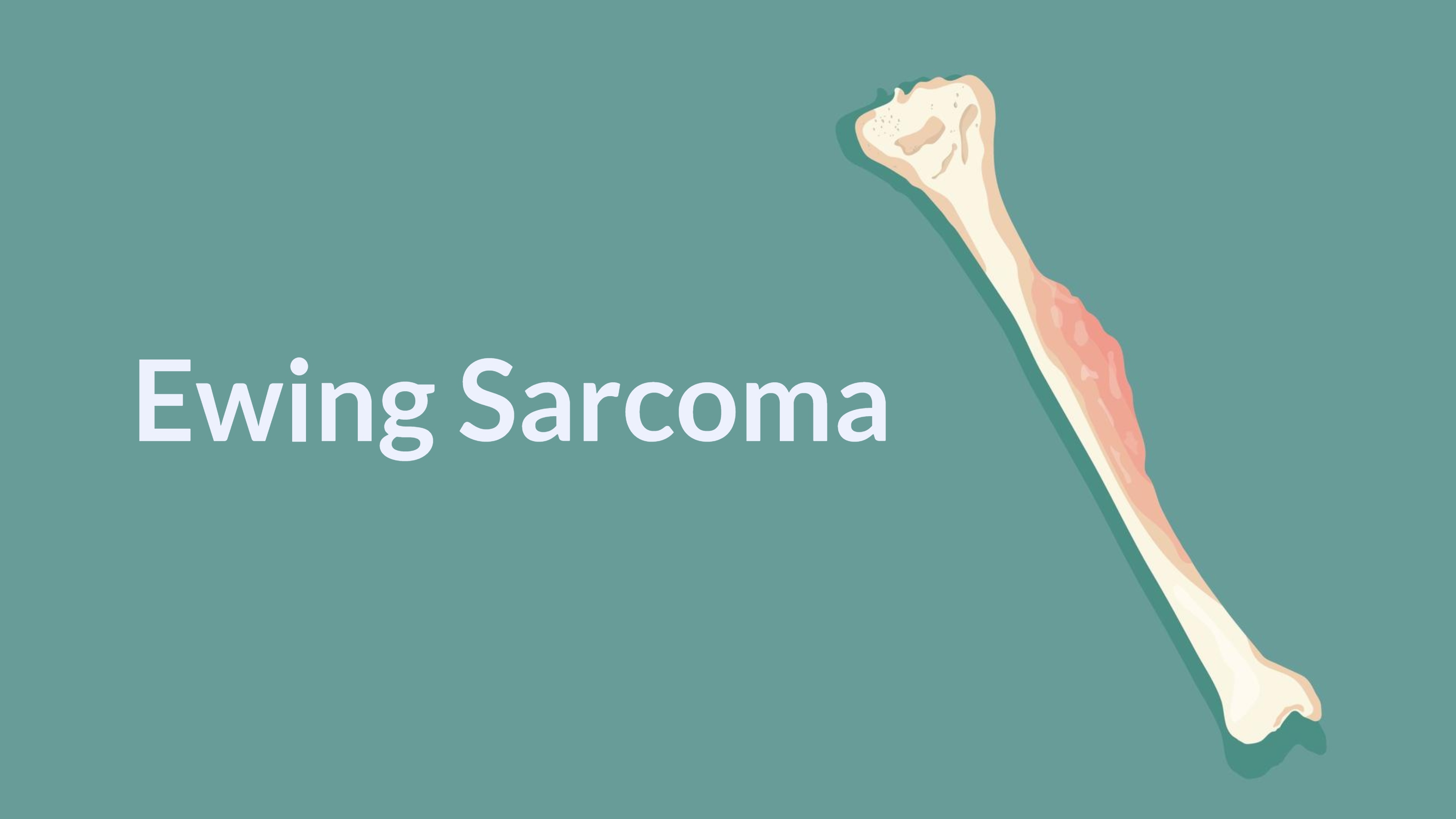 Ewing Sarcoma