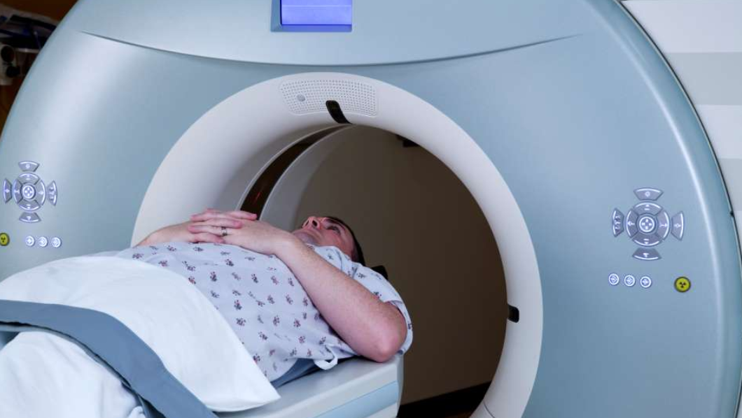 Post-Surgery Radiation