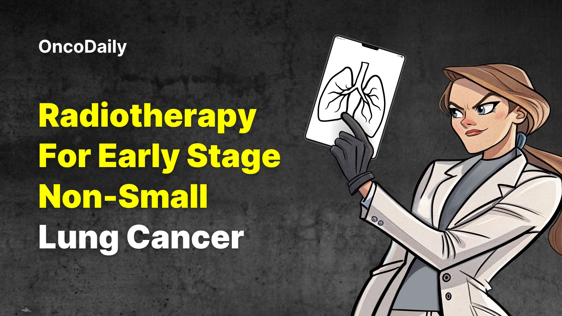 Radiotherapy for Early Stage NSCLC