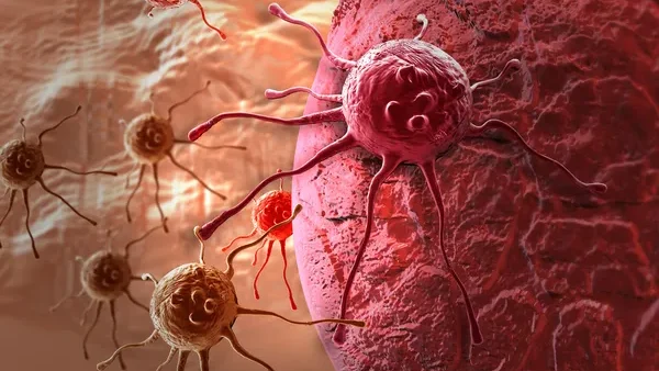 Tumor-Infiltrating Lymphocyte
