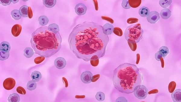 Indraneel Deshmukh Shweta Bansal Acute Lymphoblastic Leukemia