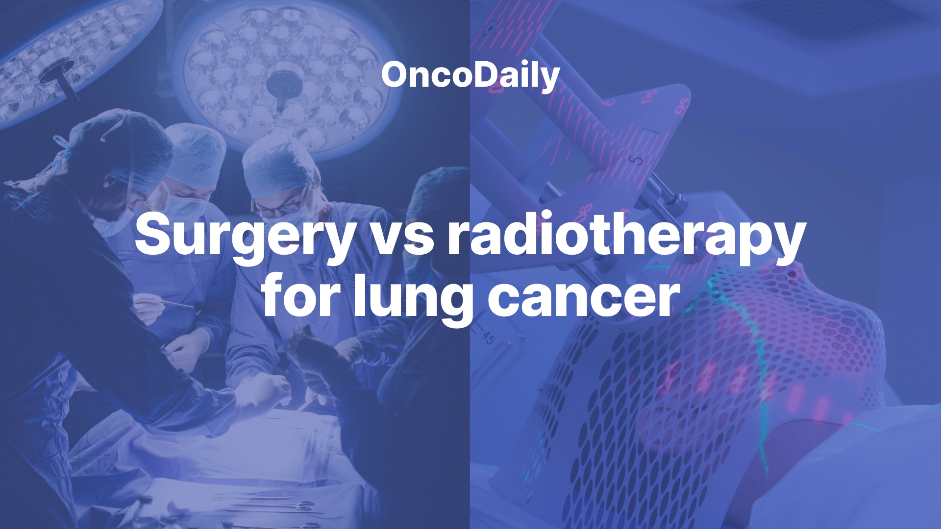Surgery or Radiotherapy