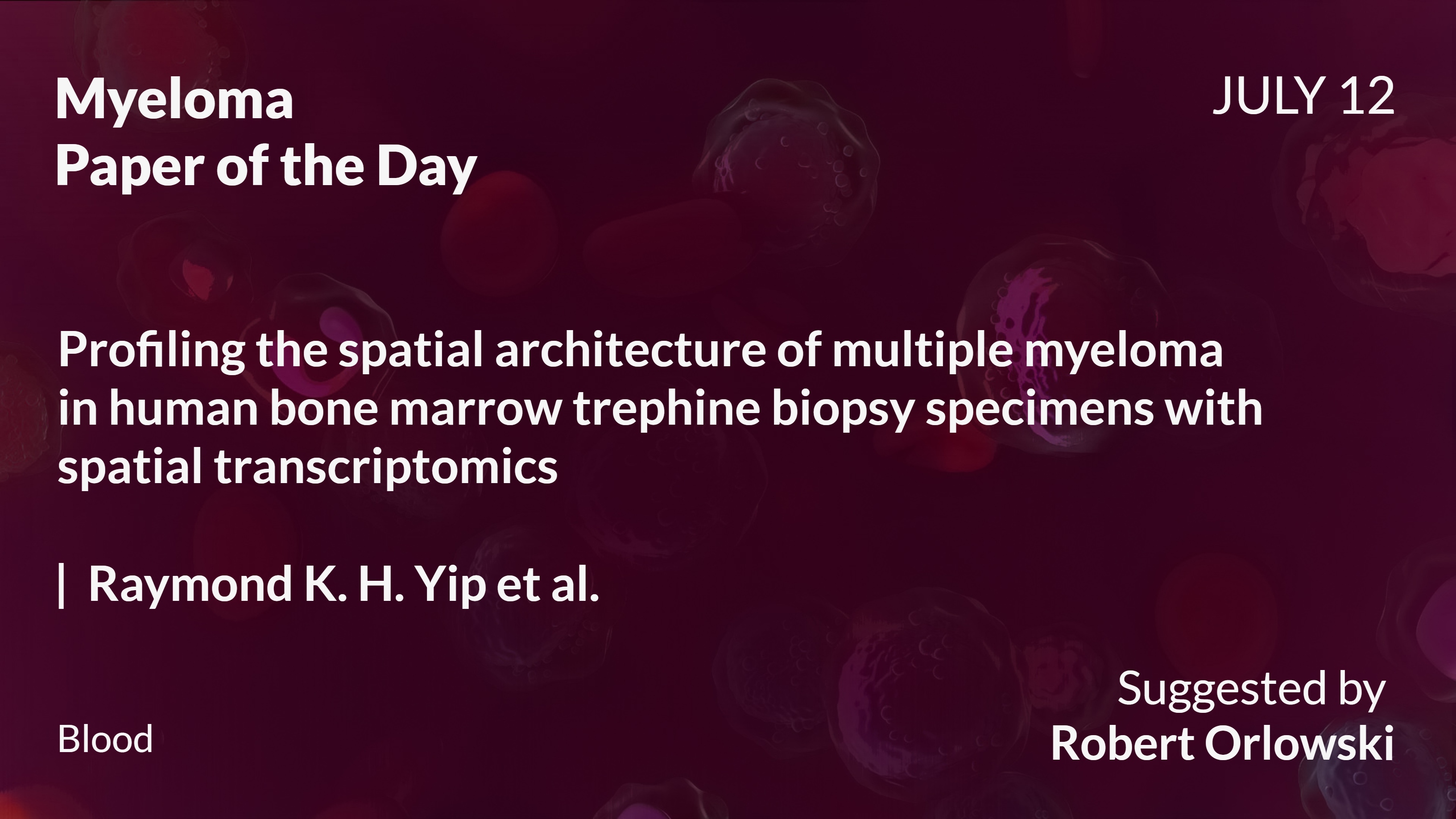Myeloma Paper of the Day