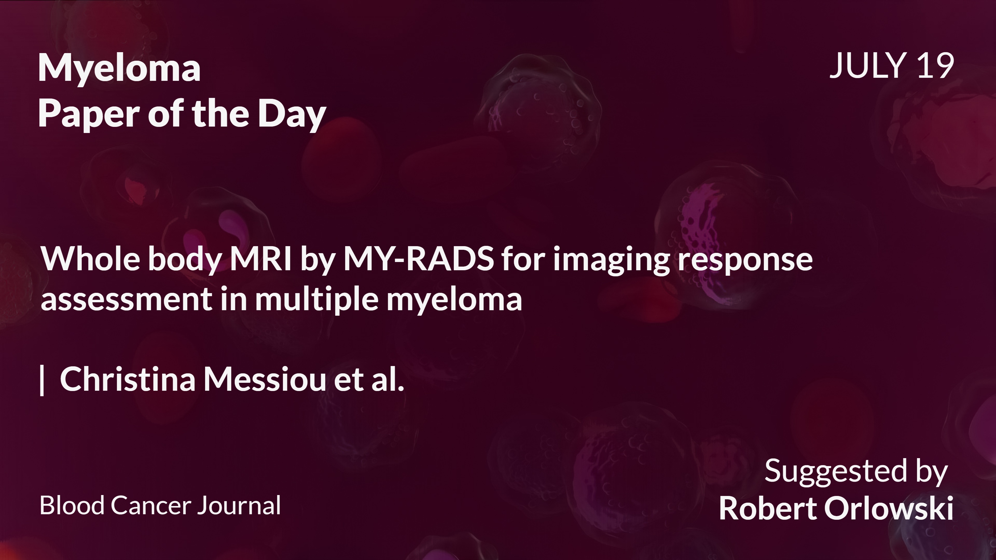 Myeloma Paper of the Day