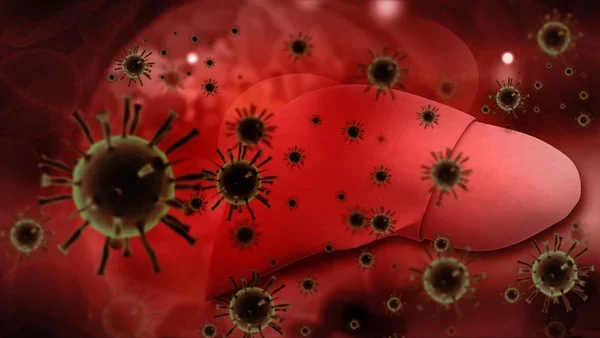 Hepatitis