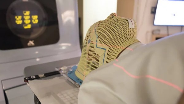 CNS Radiation Oncology