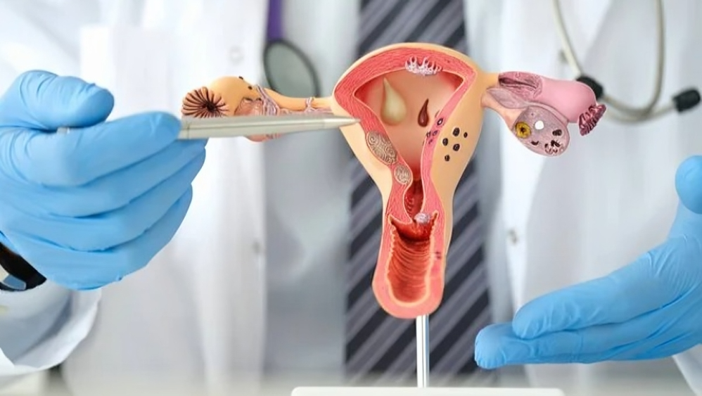 Gynecological Cancer