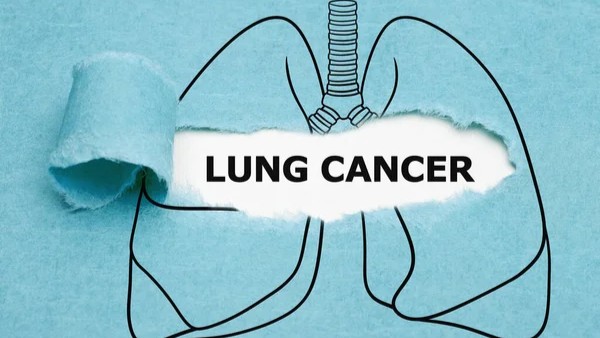 Lung Cancer, Societal Aspect