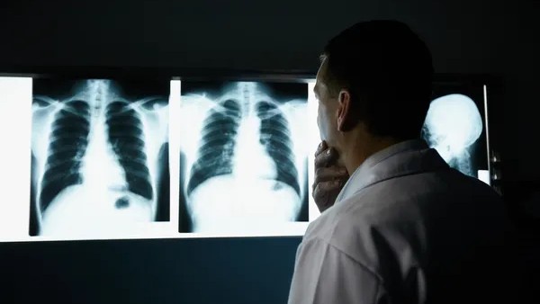 Lung Cancer Mortality
