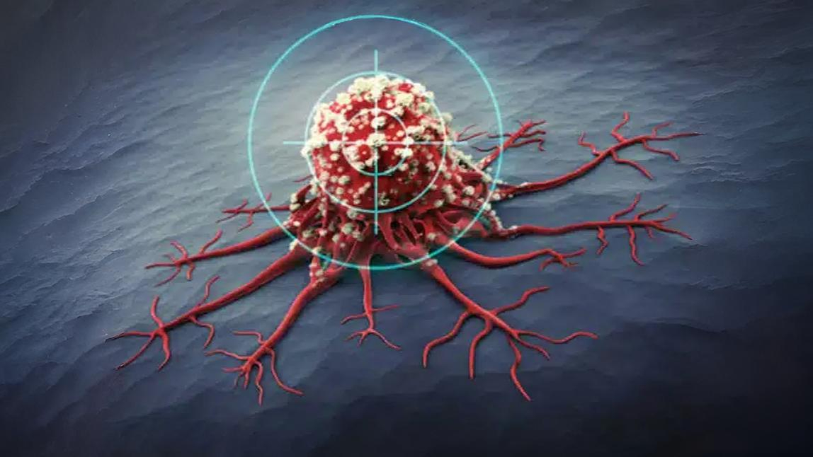 Solid Tumour